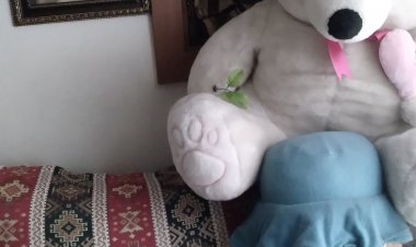 SAÇIMDAKİ BU AKLAR NEDEN?